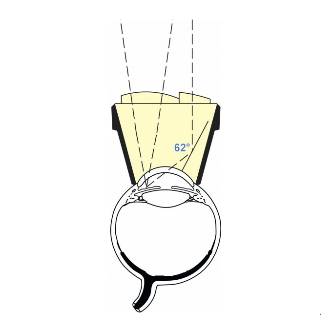Gonio lente di Pollack per Iridotomia