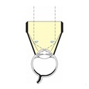 Gonio lente di Thorpe 4 specchi Laser