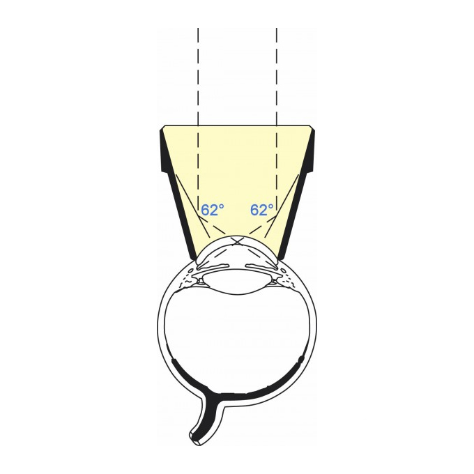 Goniolente  a 2 specchi