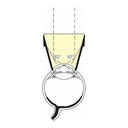 Goniolente  a 2 specchi