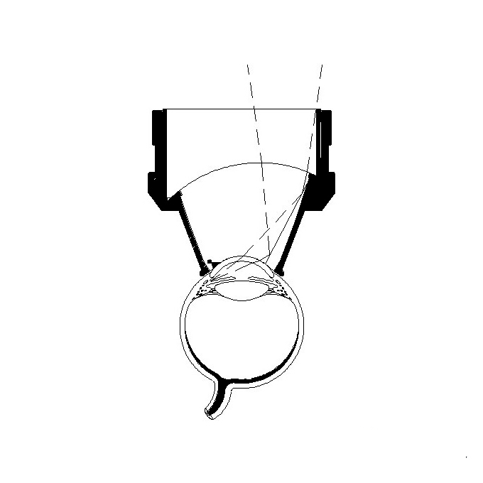 Goniolente graduata di Kapetansky