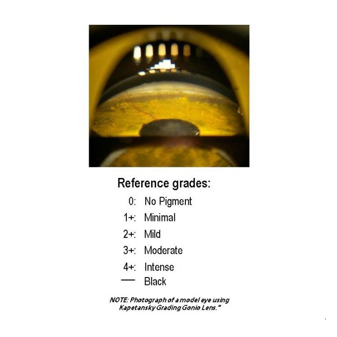 Goniolente graduata di Kapetansky