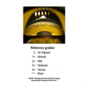 Goniolente graduata di Kapetansky