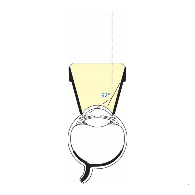 Gonio lente singolo Specchio Laser