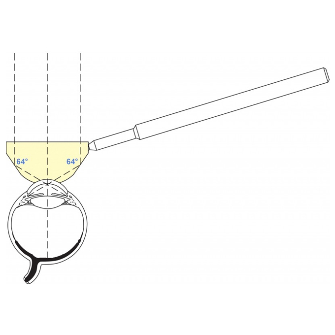 Gonioprisma Posner chir/diagn. Manico tondo