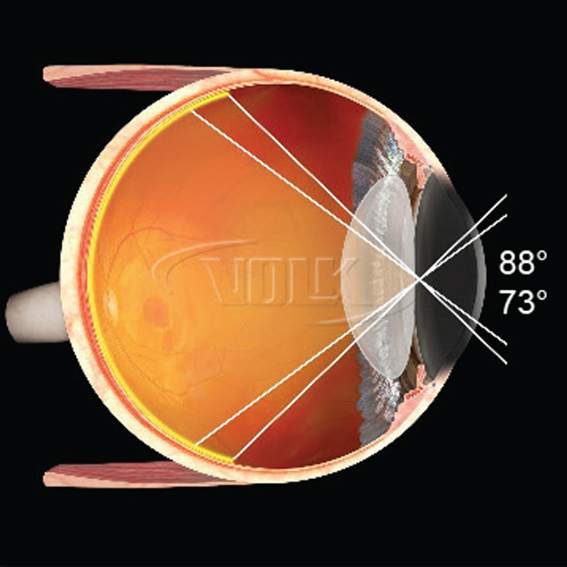 Lente Volk Central Retinal ACS Vitrectomia (copia)