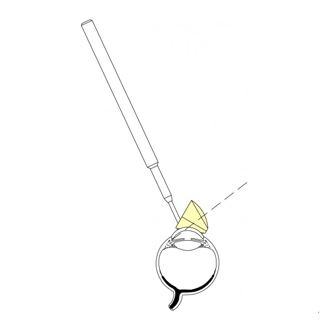 Gonioprisma di Swan Jacob autoclavabile 8 mm