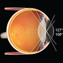 Lente Volk MiniQuad Vitrectomia