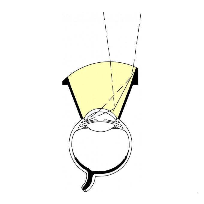 Lente goniometrica MV200