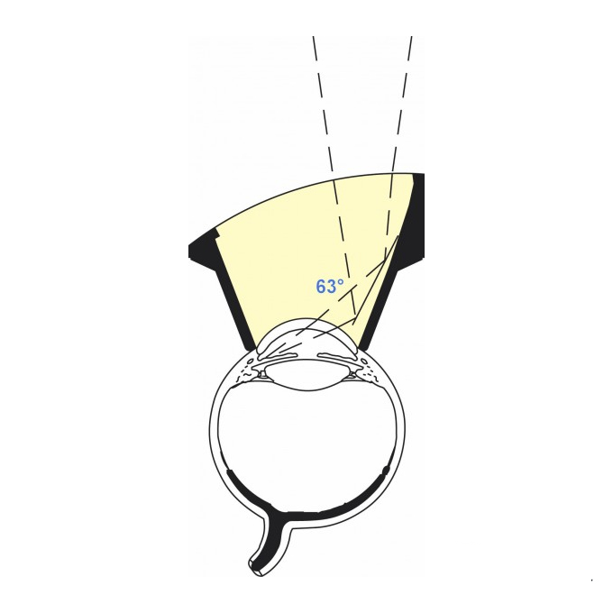 Lente laser SLT di Hwang Latina 5.0
