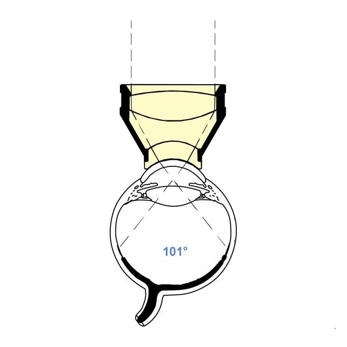 Lente Equatoriale di Landers NA