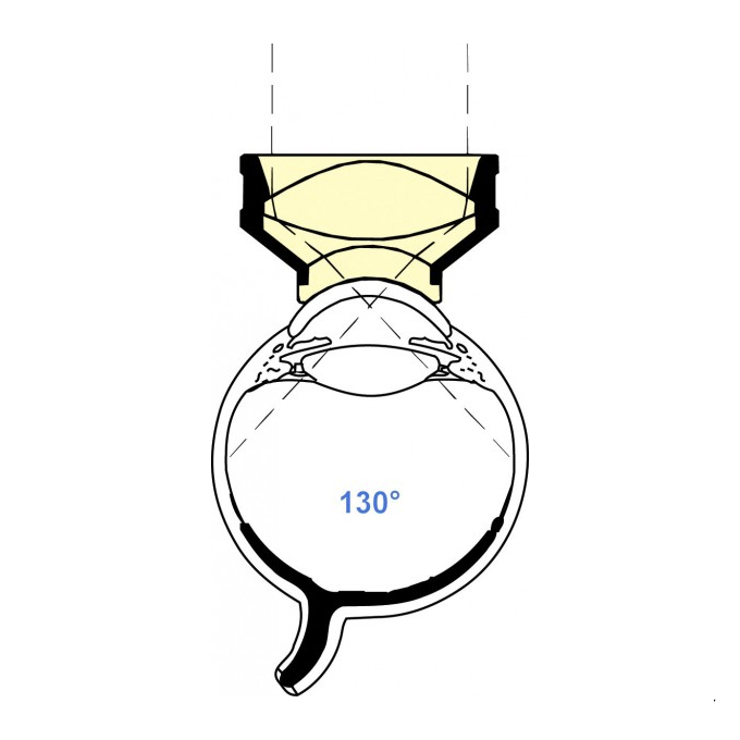 Lente Vitrectomia  Wide Angle Wide Field di Landers