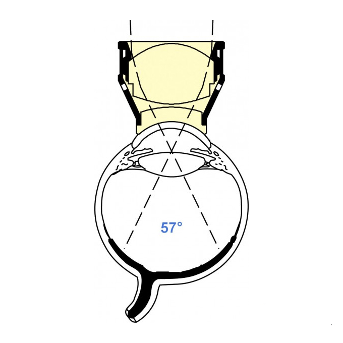 Lente Vitrectomia Ampio campo ingrandente di Woldoff