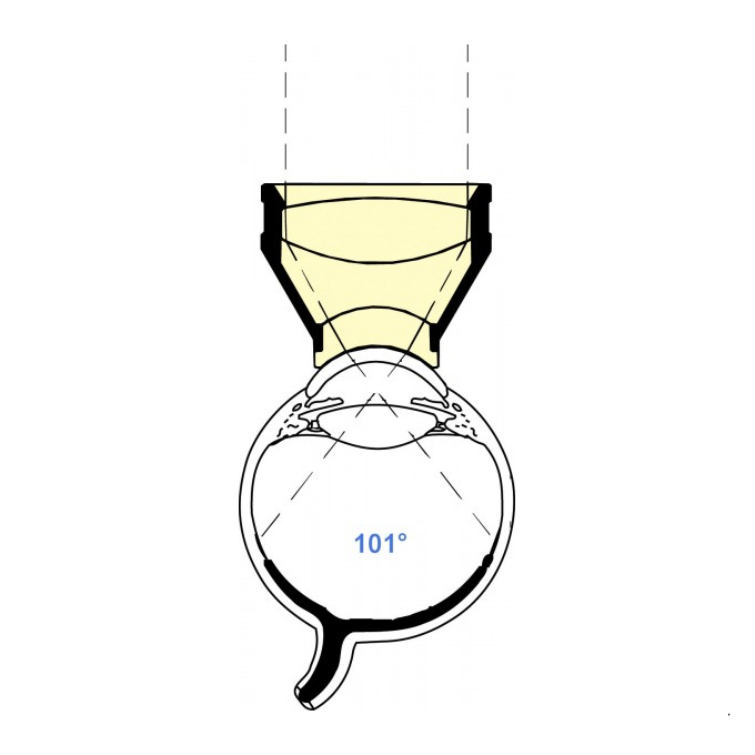Lente Vitrectomia Equatoriale II di Landers