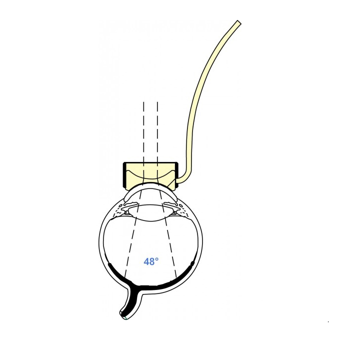 Lente Vitrectomia c/manico Wide Field