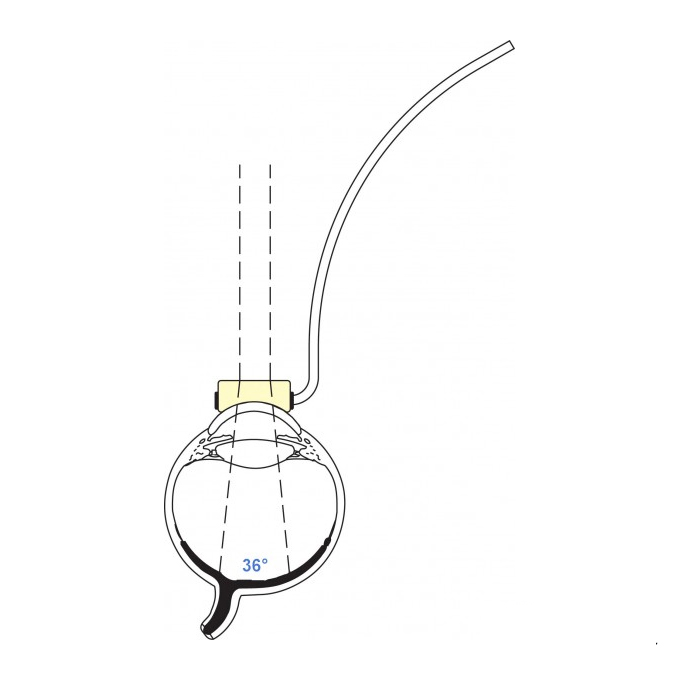Lente Vitrectomia piatta c/manico