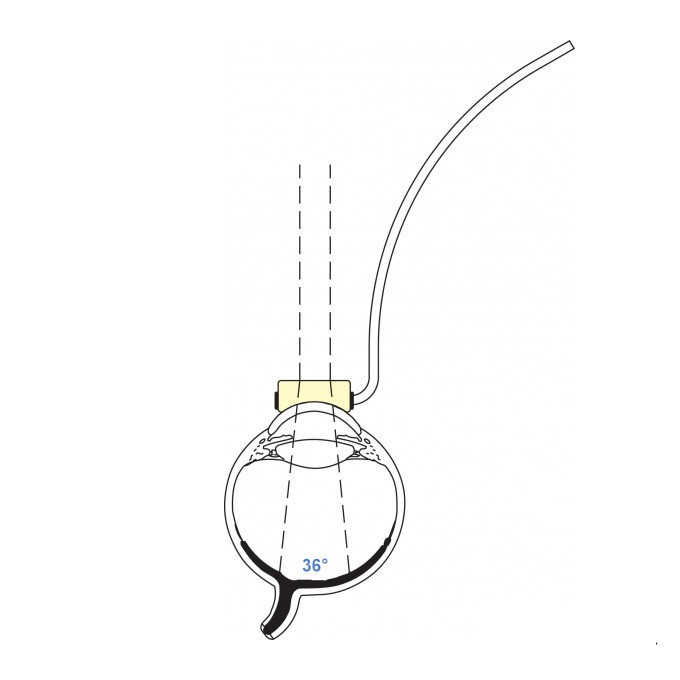 Lente Vitrectomia piatta con infusione