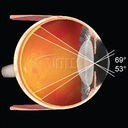 Lente Volk 28 D sterilizzabile