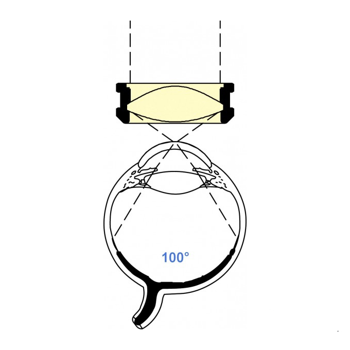 Lente da 132D indiretta per visione chirurgica