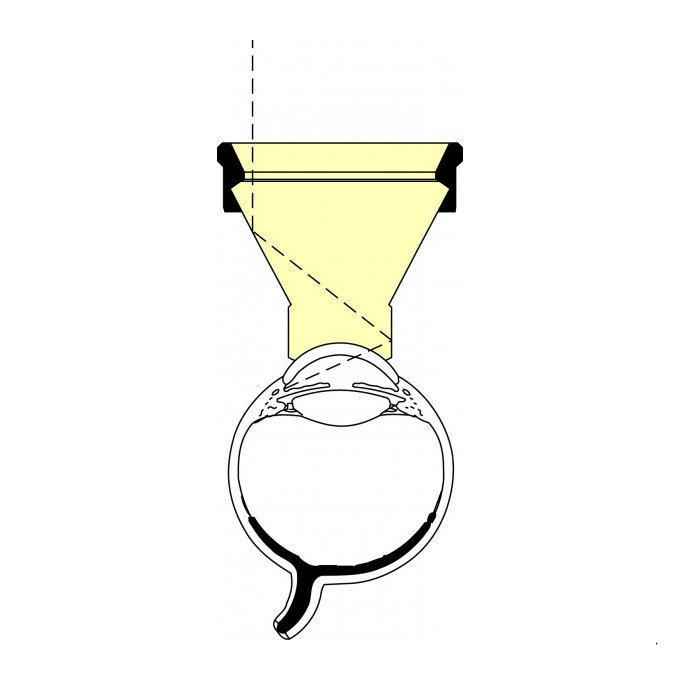 Lente di Khaw diretta 4D per gonio
