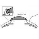 Lente di Landers ampio campo Keratoprotesi temporanea