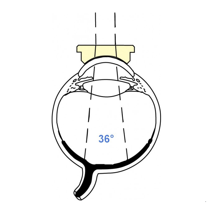 Lente di Machemer piatta