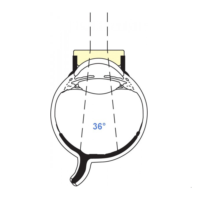 Lente di Machemer piatta plus