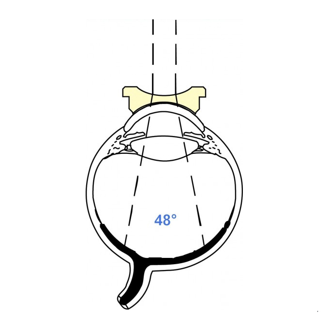 Lente di Peyman Ampio campo
