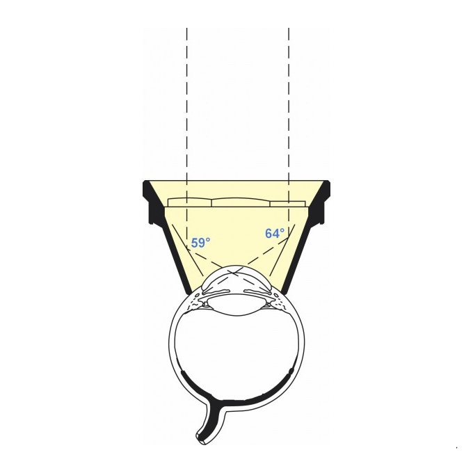 Lente di Ritch Trabeculoplastica