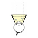 Lente di Ritch Trabeculoplastica