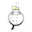 Lente di Tolentino prismatica 20° Alta risoluz.