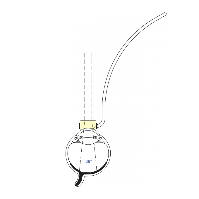 Lente piatta pediatrica con manico viola e infusione