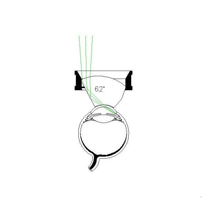 Gonio lente chirurgica 1.5X di Ahmed con manipolo